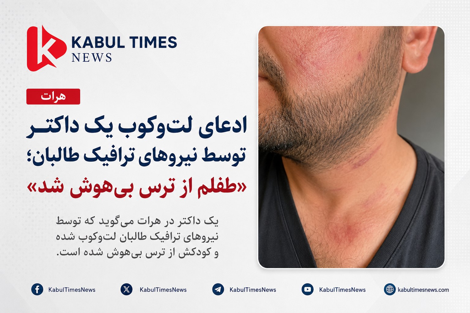Doctor in Herat allegedly beaten by Taliban traffic police; “My child fainted from fear”
